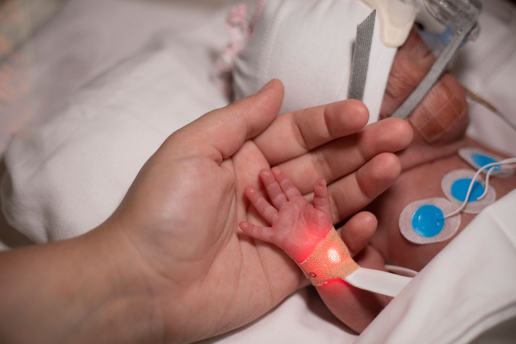 Le mani di una mamma e del suo bimbo prematuro
